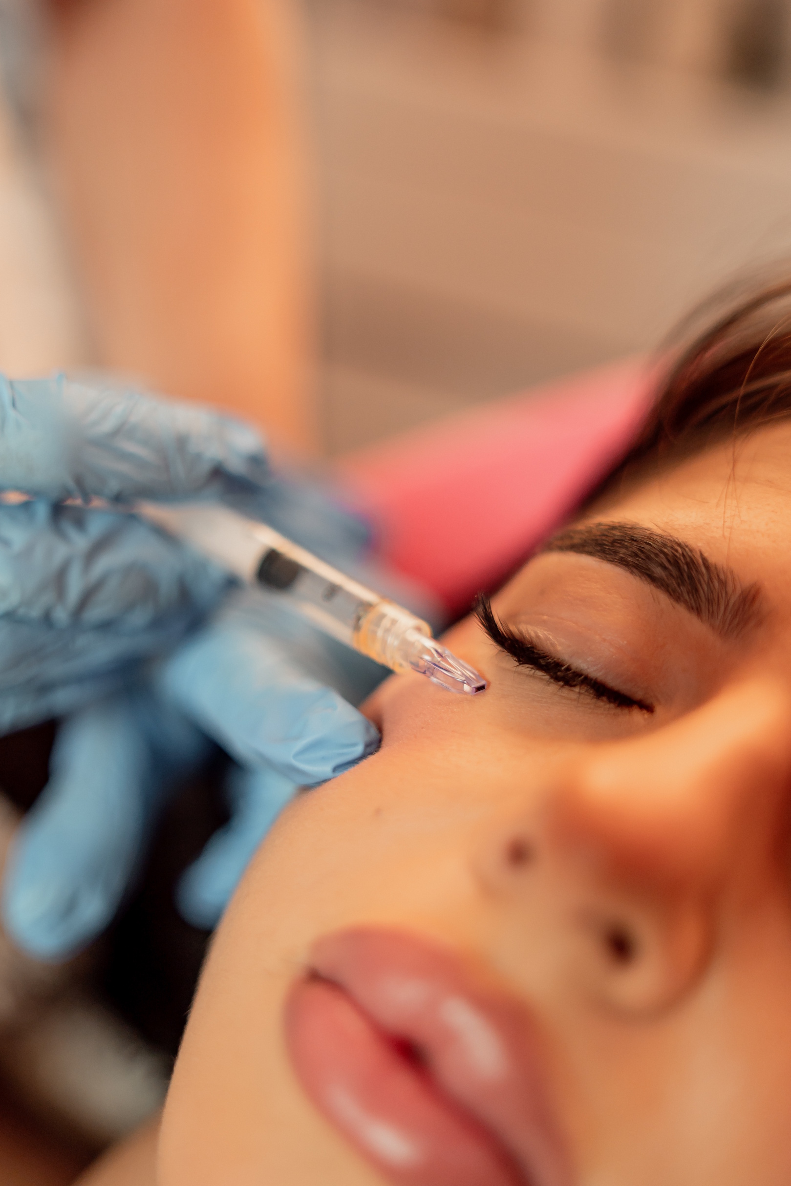 micro needle face treatment